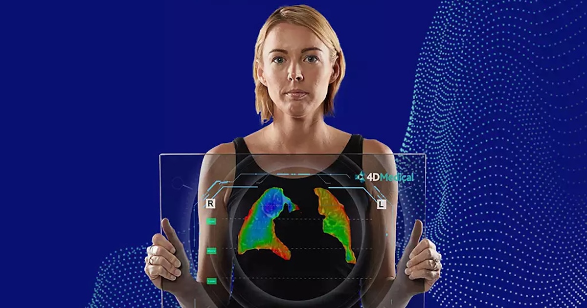 A person holding a holographic screen featuring an AI analysis of their lungs
