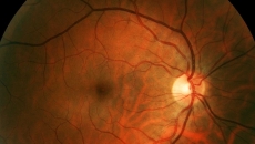 Retinal image