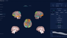 A view of the JLK Medihub Atroscan