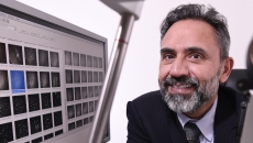 corneal confocal microscopy, COVID-19, long COVID, ophthalmology, Weill Cornell Medicine-Qatar