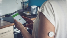 A person wearing CGM tracking blood glucose data on a smartphone