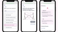 Alt text: Ubie AI Symptom Checker