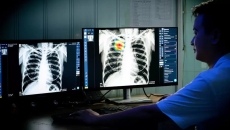 A radiologist analysing a chest X-ray using VinBrain DrAid