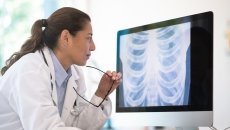 A doctor assessing a chest X-ray scan