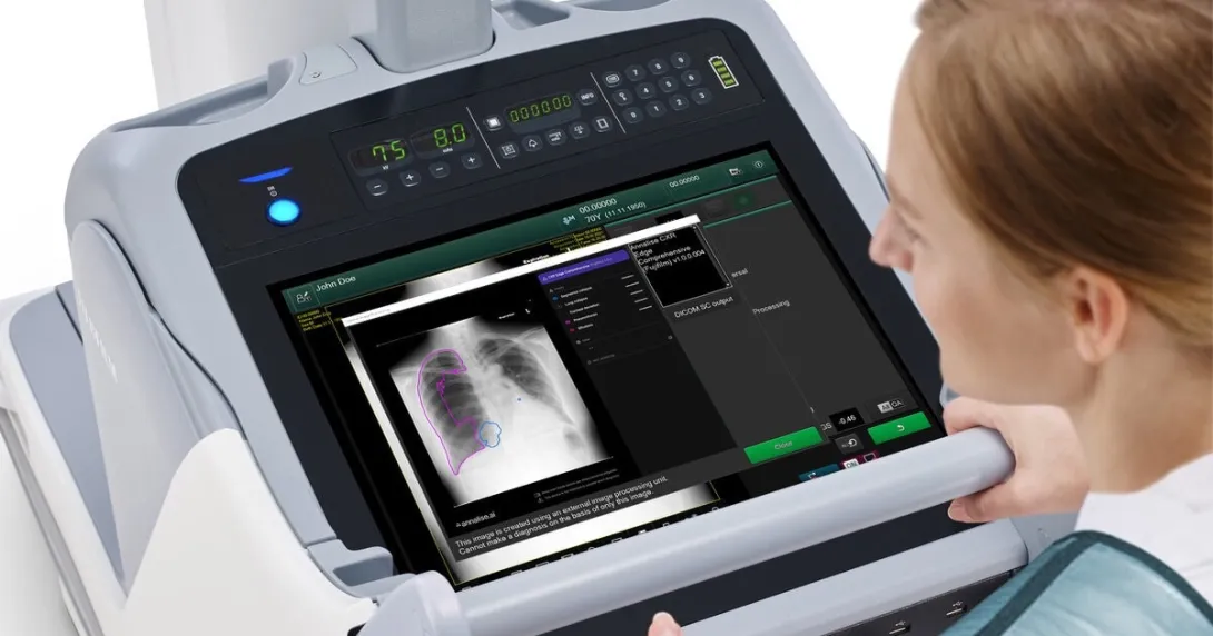 Fujifilm's FDR Go PLUS mobile x-ray