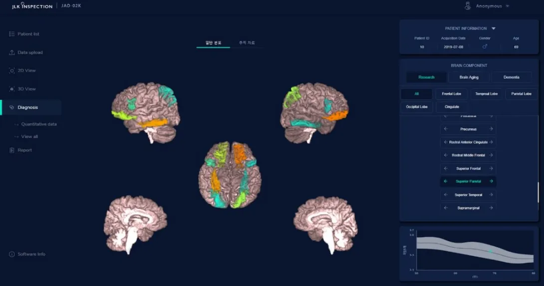 A view of the JLK Medihub Atroscan