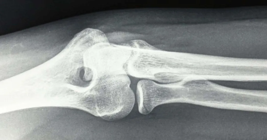 X-ray image