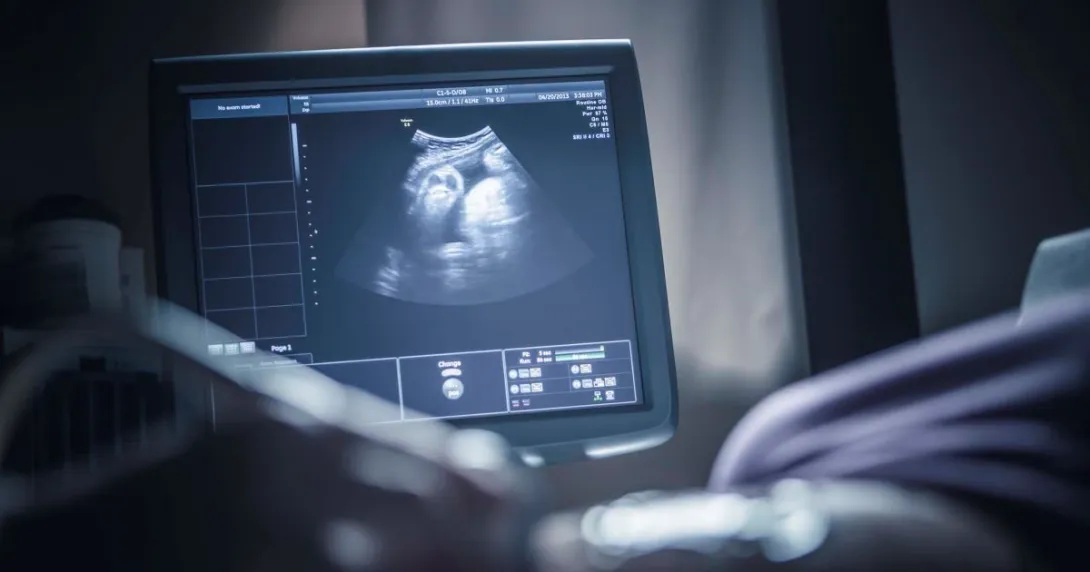 Sonogram monitor with person's hand
