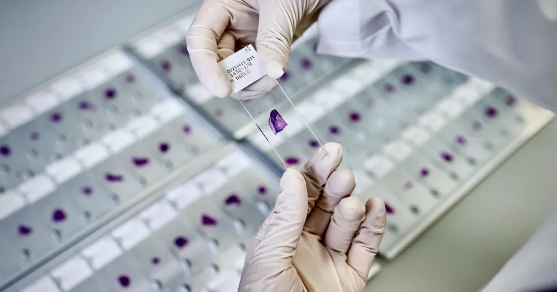 A stained slide being prepared for AI-powered analysis