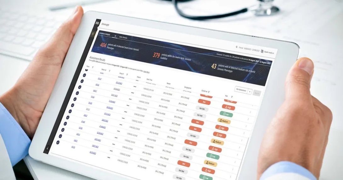 Echo IQ's heart disease diagnosis support AI software