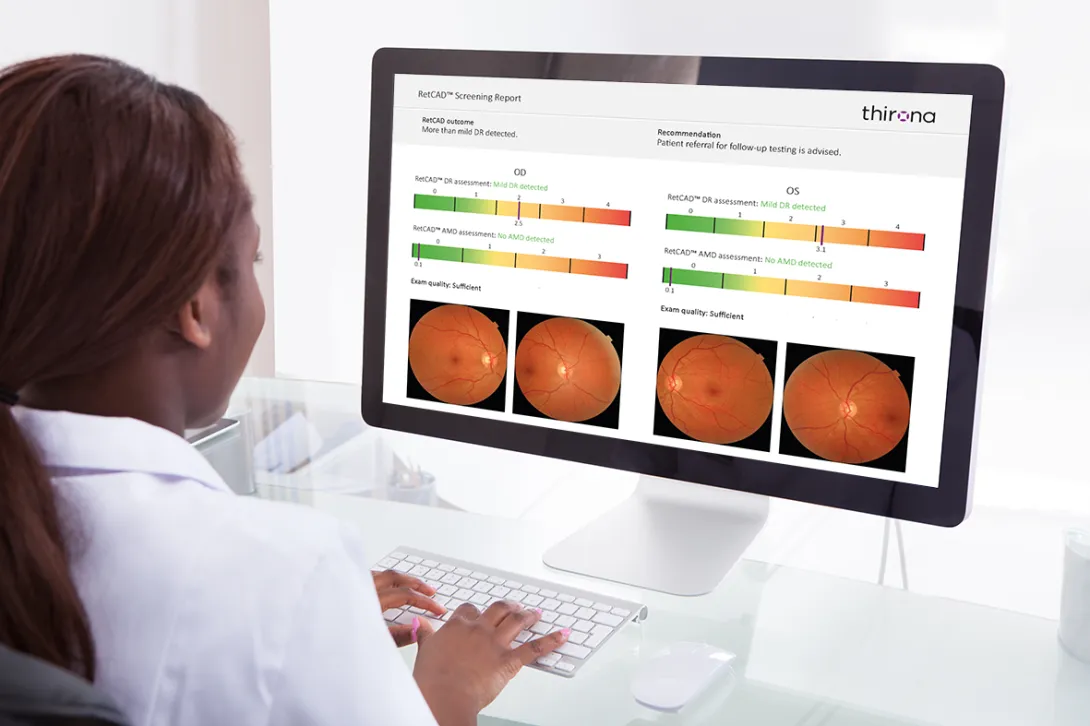 AXA Health, Thirona, Sectra, AI, Peppy