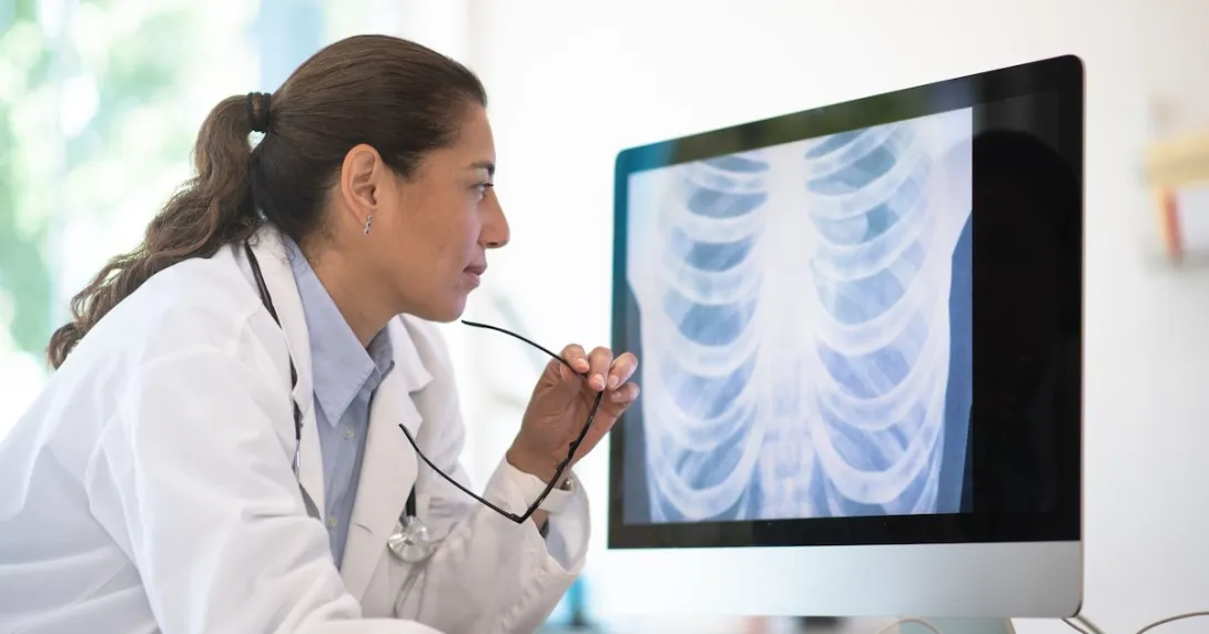 A doctor analysing a chest X-ray image